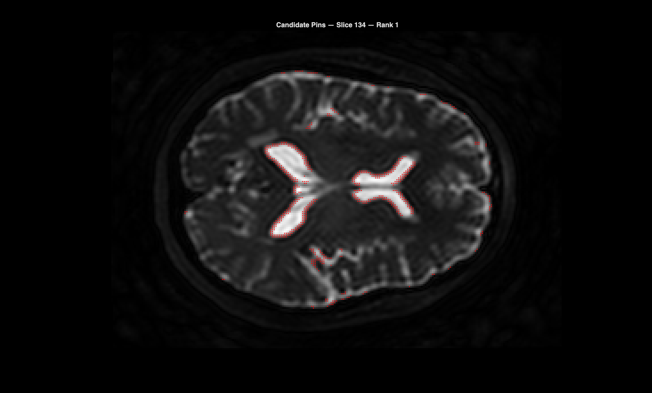 Candidate pins on MRI slice 134